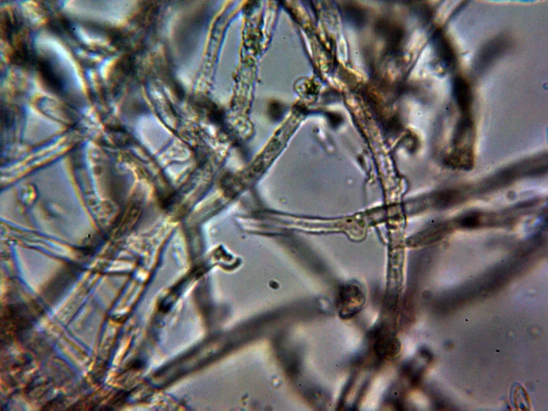 Amylocorticium cebennense 10 - Hifas subiculares con incrustaciones